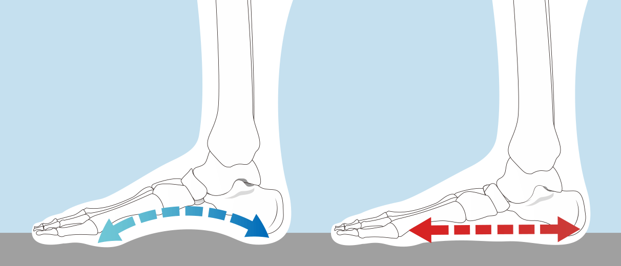 標準的なアーチとアーチのない扁平足の比較図